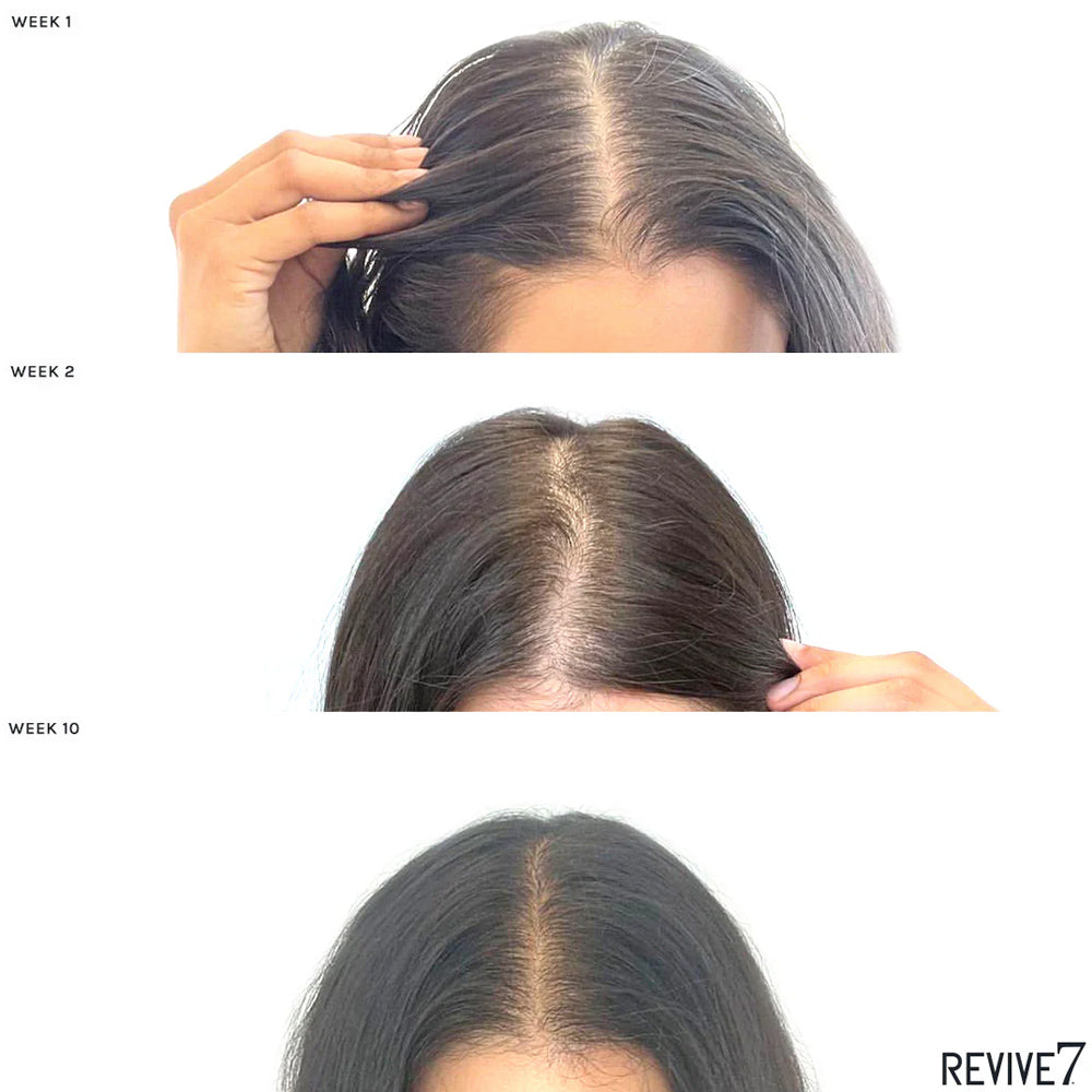 Revive7 Hair Oil 30 mL - Treatment for Thinning Hair - For Fuller Thicker Looking Hair