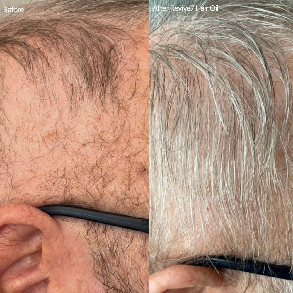 Revive7 Hair Oil 30 mL - Treatment for Thinning Hair - For Fuller Thicker Looking Hair