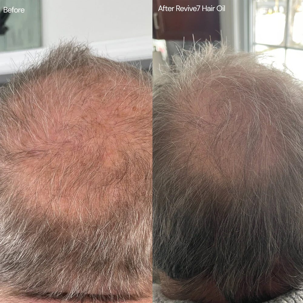 Revive7 Hair Oil 30 mL - Treatment for Thinning Hair - For Fuller Thicker Looking Hair